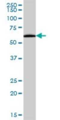 Western Blot: Pancreatic Amylase Beta Antibody [H00000280-B01P]