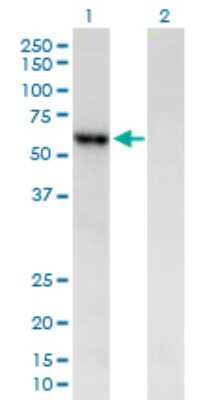 Western Blot: Pancreatic Amylase Beta Antibody [H00000280-B01P]