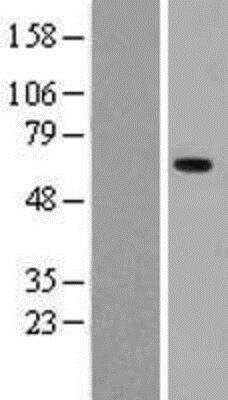 Western Blot: Pancreatic Amylase Beta Overexpression Lysate [NBL1-07510]