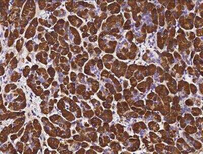 Immunohistochemistry-Paraffin: Pancreatic Lipase Antibody (120) [NBP2-90231]