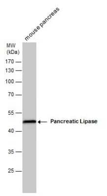 Western Blot: Pancreatic Lipase Antibody (GT1777) [NBP3-13513]