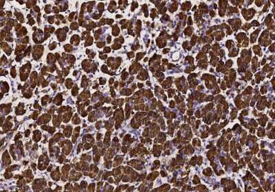 Immunohistochemistry: Pancreatic Lipase Antibody [NBP3-00154]