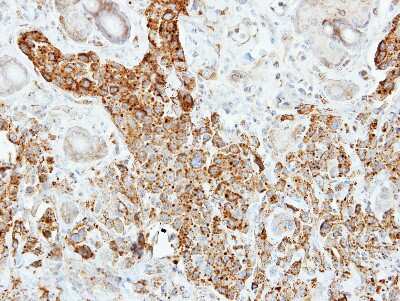 Immunohistochemistry-Paraffin: Pancreatic Lipase Antibody [NBP1-32789]