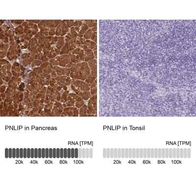 Immunohistochemistry-Paraffin: Pancreatic Lipase Antibody [NBP2-38958]