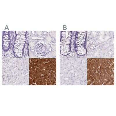 Immunohistochemistry-Paraffin: Pancreatic Lipase Antibody [NBP2-38958]