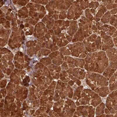 Immunohistochemistry-Paraffin: Pancreatic Lipase Antibody [NBP2-38958]