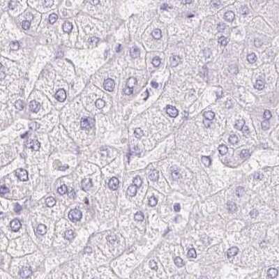 Immunohistochemistry-Paraffin: Pancreatic Lipase Antibody [NBP2-38958]