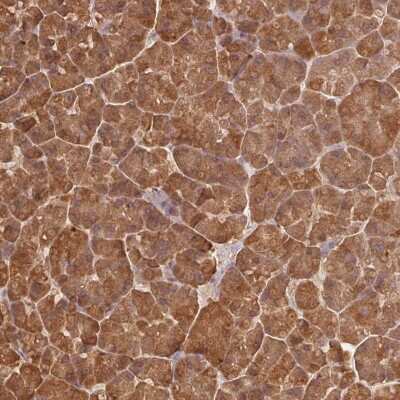 Immunohistochemistry-Paraffin: Pancreatic Lipase Antibody [NBP2-38962]