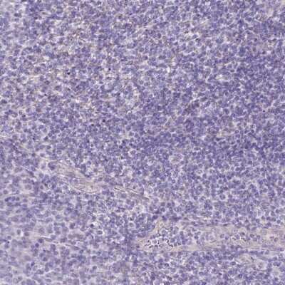Immunohistochemistry-Paraffin: Pancreatic Lipase Antibody [NBP2-38962]
