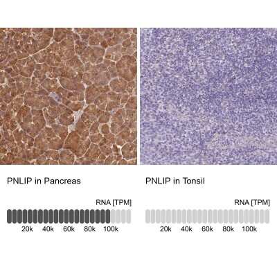 Immunohistochemistry-Paraffin: Pancreatic Lipase Antibody [NBP2-38962]