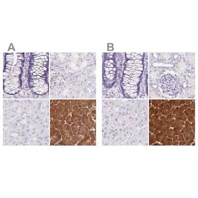 Immunohistochemistry-Paraffin: Pancreatic Lipase Antibody [NBP2-38962]