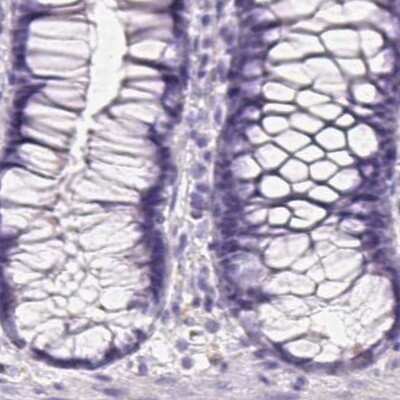 Immunohistochemistry-Paraffin: Pancreatic Lipase Antibody [NBP2-38962]