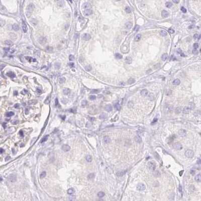 Immunohistochemistry-Paraffin: Pancreatic Lipase Antibody [NBP2-38962]