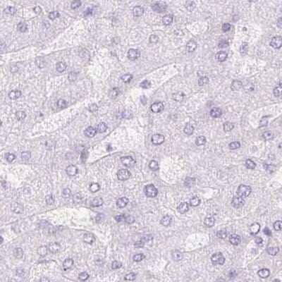 Immunohistochemistry-Paraffin: Pancreatic Lipase Antibody [NBP2-38962]