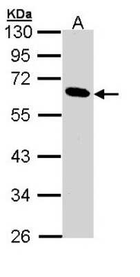 Pancreatic Lipase Antibody (NBP1-32789) by Novus, Part of Bio-Techne