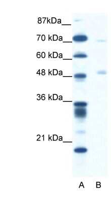 Western Blot: Pancreatic Lipase Antibody [NBP1-57981]