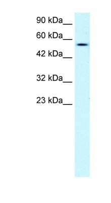 Western Blot: Pancreatic Lipase Antibody [NBP1-58034]