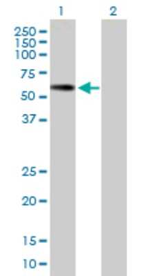 Western Blot: Pancreatic Lipase Related Protein 2 Antibody [H00005408-B01P]