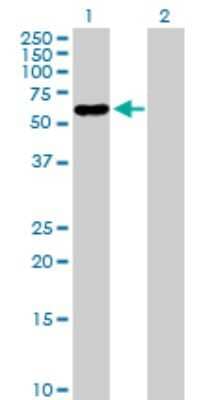Western Blot: Pancreatic Lipase Related Protein 2 Antibody [H00005408-D01P]
