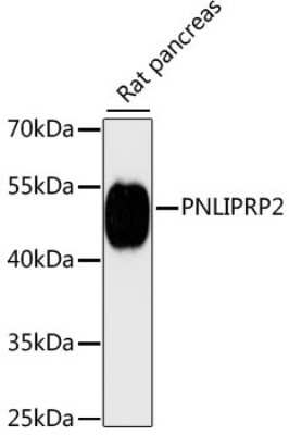 Western Blot: Pancreatic Lipase Related Protein 2 AntibodyAzide and BSA Free [NBP2-93552]