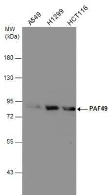 Western Blot: Pancreatic Polypeptide/PP Antibody (1964) [NBP2-43634]