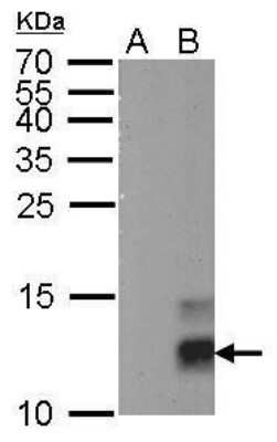 Western Blot: Pancreatic Polypeptide/PP Antibody (327) [NBP2-43664]