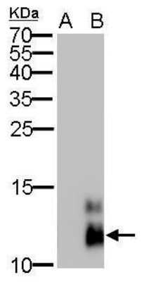 Western Blot: Pancreatic Polypeptide/PP Antibody (6512) [NBP2-43741]