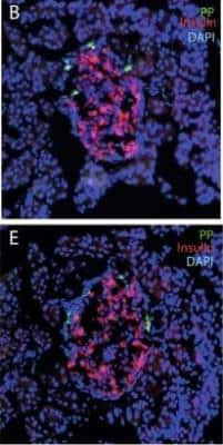 Immunocytochemistry/ Immunofluorescence: Pancreatic Polypeptide/PP Antibody [NB100-1793]