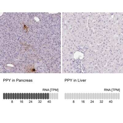 Immunohistochemistry-Paraffin: Pancreatic Polypeptide/PP Antibody [NBP2-38203]