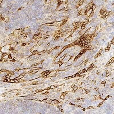 Immunohistochemistry: Panendothelial Cell Antigen Antibody (MECA-32) - Azide and BSA Free [NBP2-80903]