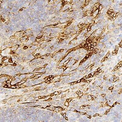 Immunohistochemistry-Paraffin: Panendothelial Cell Antigen Antibody (MECA-32) - BSA Free [NB100-77668]