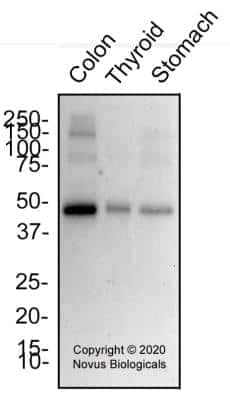 Western Blot: Panendothelial Cell Antigen Antibody (MECA-32)BSA Free [NB100-77668]