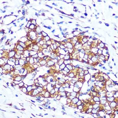 Immunohistochemistry-Paraffin: Pannexin-1 Antibody (7E8T3) [NBP3-16578]