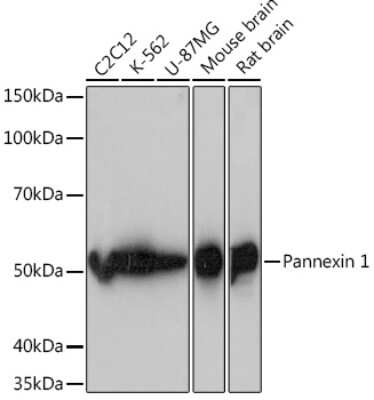 Western Blot: Pannexin-1 Antibody (7E8T3) [NBP3-16578]