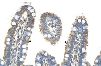 Immunohistochemistry: Pannexin-1 Antibody [NBP1-59672]