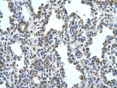Immunohistochemistry: Pannexin-1 Antibody [NBP1-59672]
