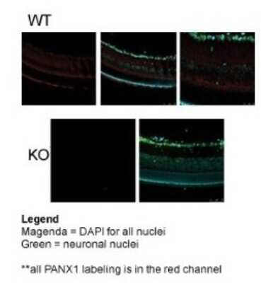Immunohistochemistry-Paraffin: Pannexin-1 Antibody [NBP1-59672]