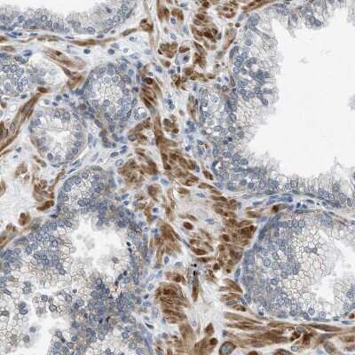Immunohistochemistry-Paraffin: Pannexin-1 Antibody [NBP1-92241]