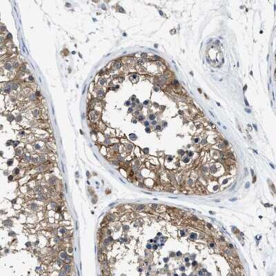 Immunohistochemistry-Paraffin: Pannexin-1 Antibody [NBP1-92241]