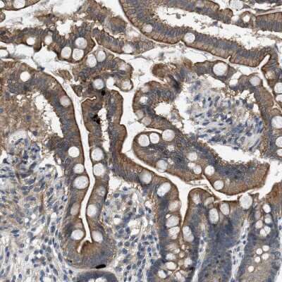 Immunohistochemistry-Paraffin: Pannexin-1 Antibody [NBP1-92241]