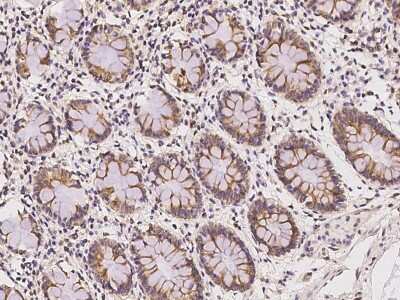 Immunohistochemistry-Paraffin: Pannexin-1 Antibody [NBP2-97446]