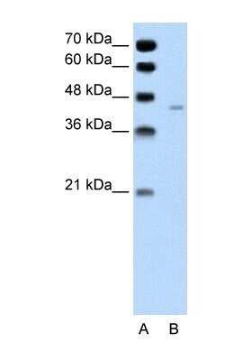 Western Blot: Pannexin-1 Antibody [NBP1-59672]