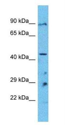 Western Blot: Pannexin-1 Antibody [NBP1-59672]