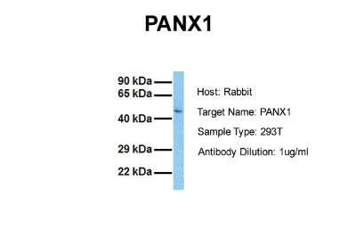 Western Blot: Pannexin-1 Antibody [NBP1-59672]