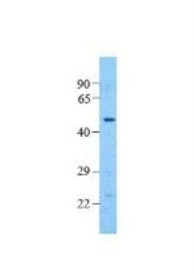 Western Blot: Pannexin-1 Antibody [NBP1-59672]