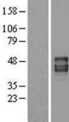 Western Blot: Pannexin-1 Overexpression Lysate [NBL1-14093]