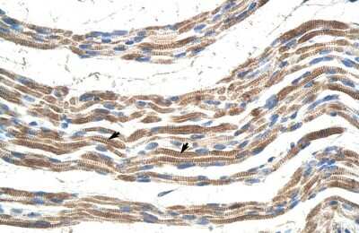 Immunohistochemistry-Paraffin: Pannexin-2 Antibody [NBP1-59671]