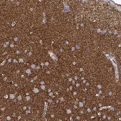 Immunohistochemistry-Paraffin: Pannexin-2 Antibody [NBP1-92242]