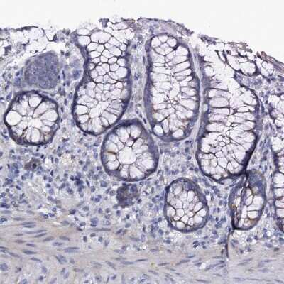 Immunohistochemistry-Paraffin: Pannexin-2 Antibody [NBP1-92242]