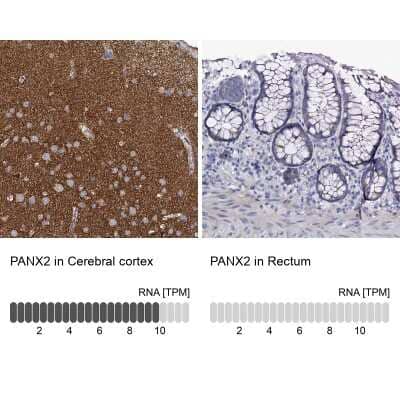 Immunohistochemistry-Paraffin: Pannexin-2 Antibody [NBP1-92242]